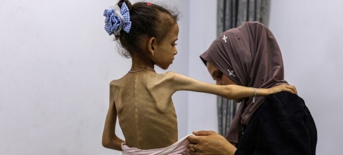 UNICEF предупреждает: Дети в секторе Газа умирают от голода